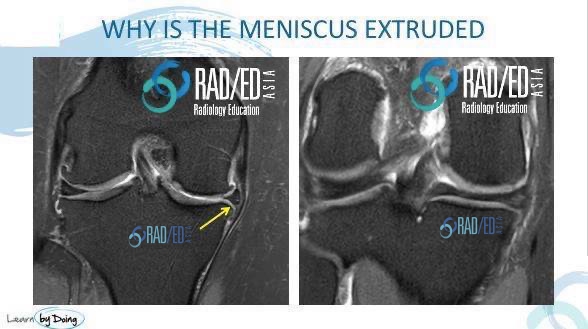 KNEE QUIZ 01 – Radiology Education Asia