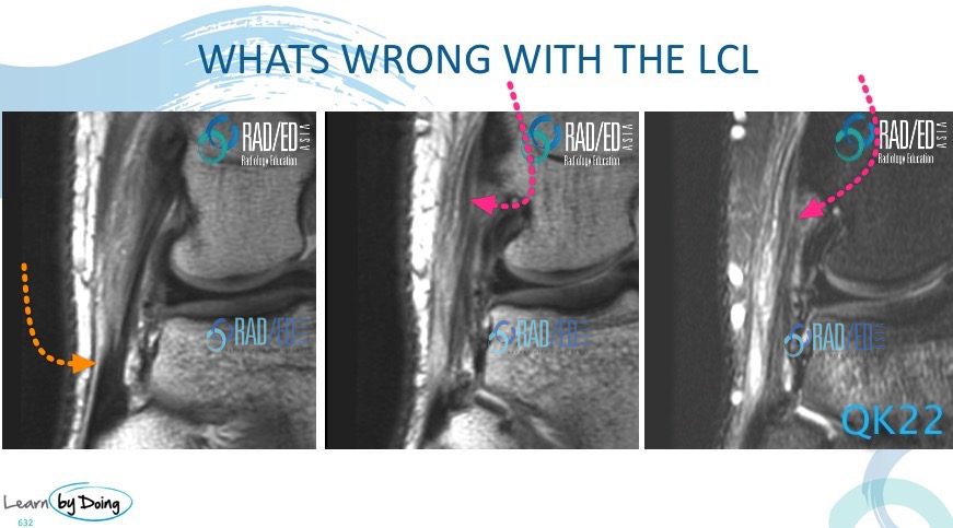 KNEE QUIZ 03 – Radiology Education Asia