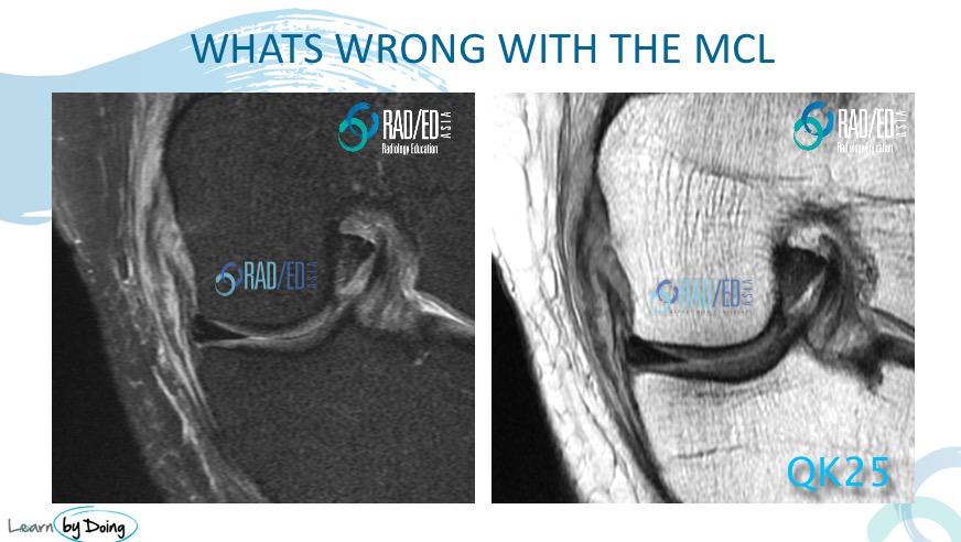 Knee Quiz 03 – Radiology Education Asia