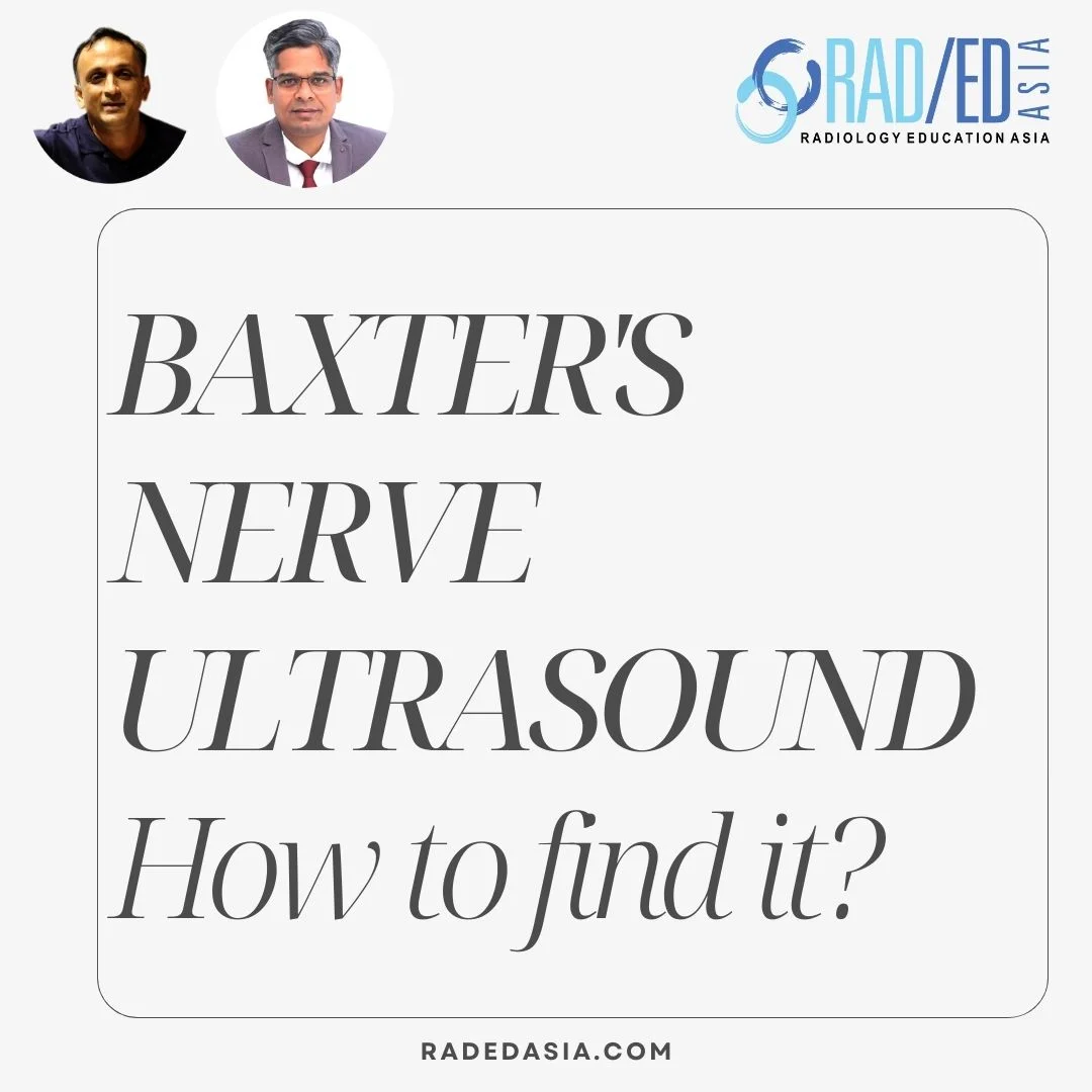 ultrasound-ankle-foot-baxter's-nerve-inferior-calcaneal-nerve-entrapment-radiology-radedasia