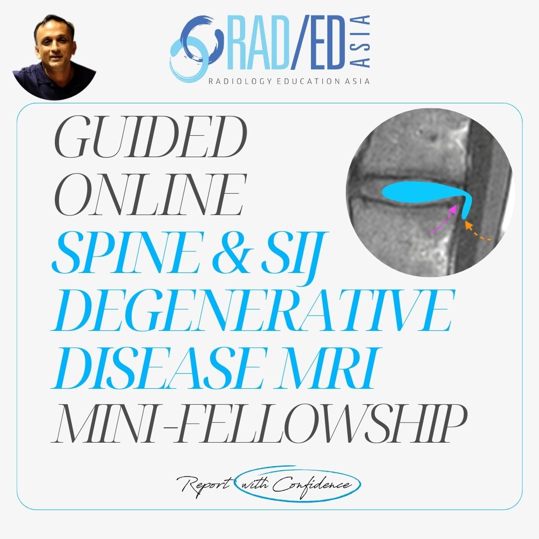 spine sij degeneration mri online course learn radiology imaging ct xray radedasia