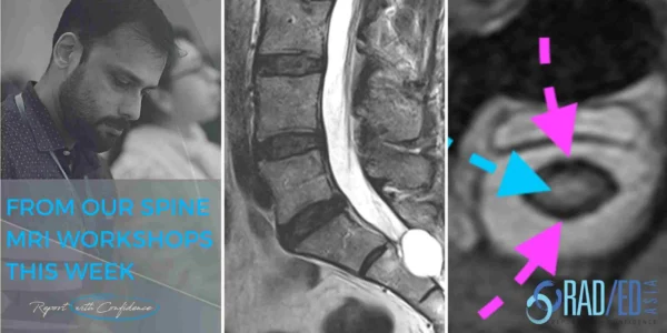 spine-facet-joint-mri-online-radiology-courses