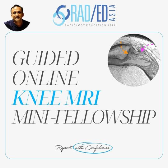 knee-mri-msk-online-musculoskeletal-course-learn-radiology-radedasia.jpg