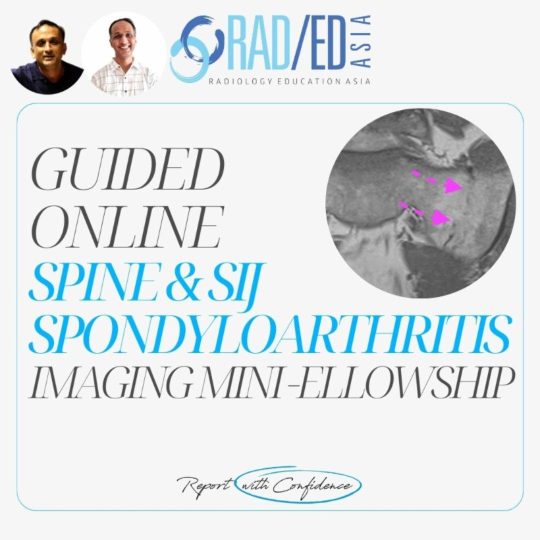 spine-sij-arthritis-spondyloarthropathies-mri-online-course-learn-radiology-imaging-ct-xray-radedasia.jpg